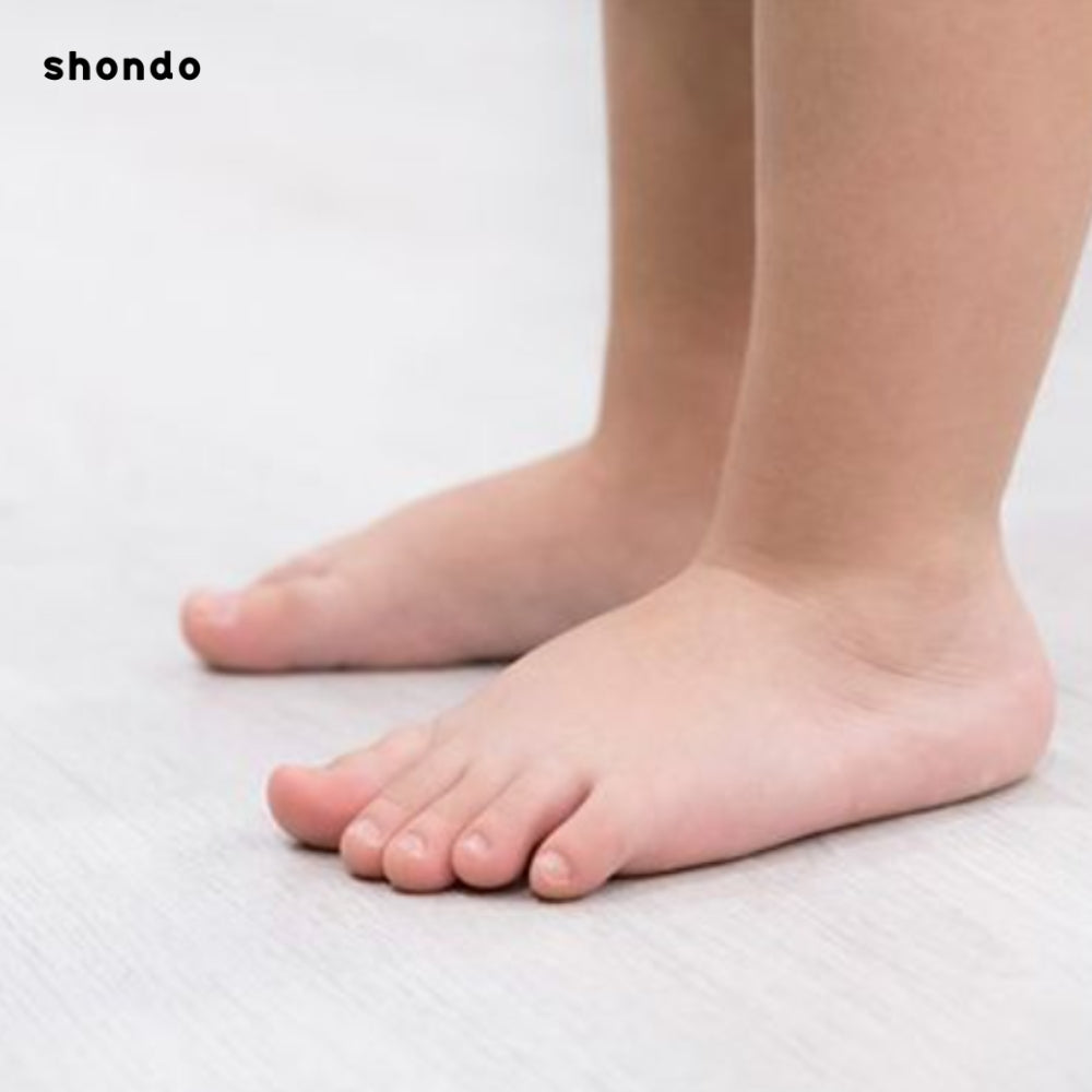 Bàn chân bẹt ở trẻ em: Dấu hiệu, nguyên nhân và cách điều trị