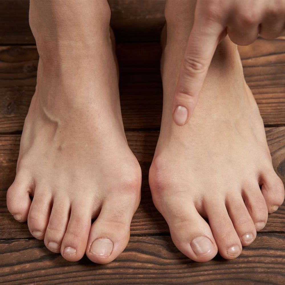 Chân ra mồ hôi nên đi dép gì