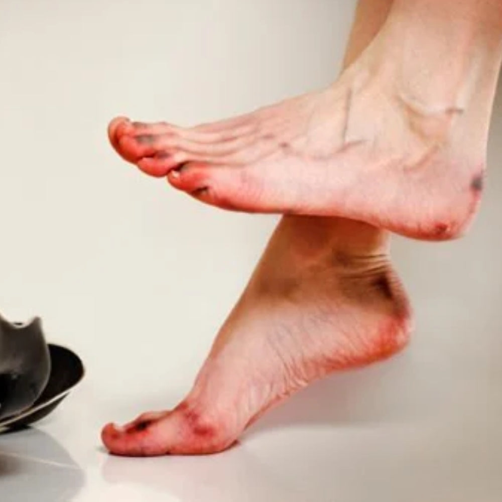 Đi giày chật có sao không