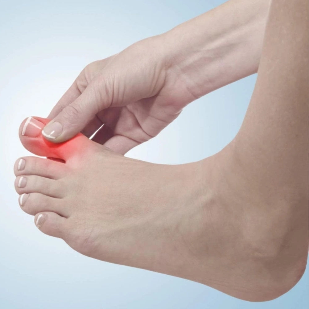 Mang giày bị chai ngón chân